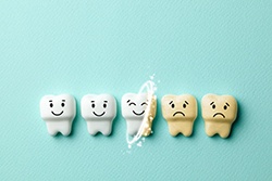 Illustration of teeth whitening in Texarkana
