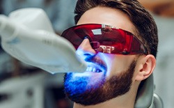 A man getting his teeth whitened by a dentist