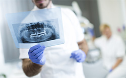 Dental x-rays held up by dentist