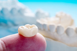 An all-ceramic crown resting on a fingertip