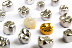 Multiple types of dental crowns on a white surface