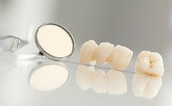 dental crown and bridge