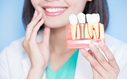 Dentist holds model of dental implants in Texarkana 