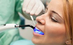 woman getting dental sealants