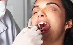 woman getting checked for oral cancer