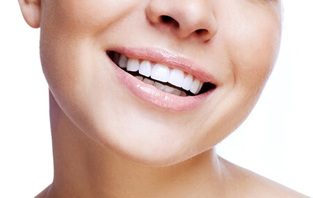 woman with veneers