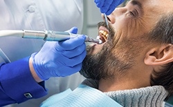 Man receiving root canal therapy
