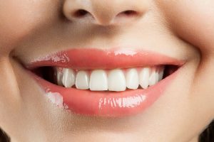 Cosmetic dentist in Texarkana offers ZOOM! Whitening.”>