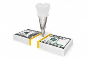 dental implant post on top of stack of cash 